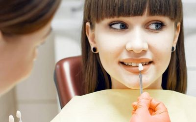 ¿Qué son las carillas dentales?, ¿cómo se ponen?
